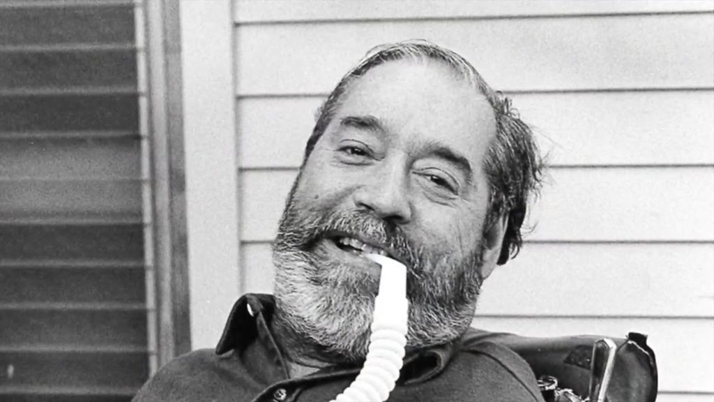middle-aged man smiling at the camera with a tube in his mouth