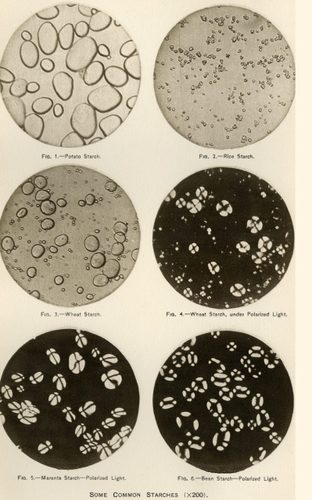 Microscopic views of some common starches