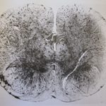 Human Spinal Cord of Embryo at Eight Months