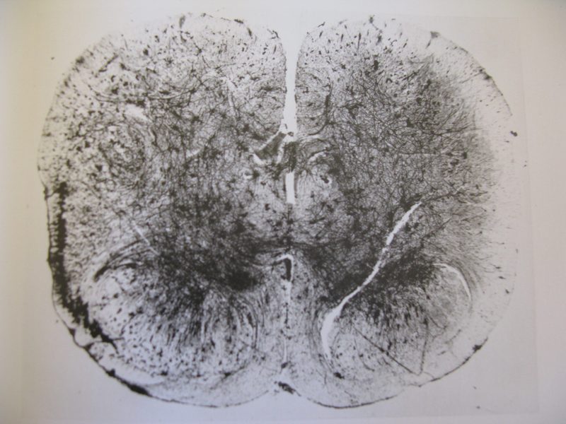 Human Spinal Cord of Embryo at Eight Months
